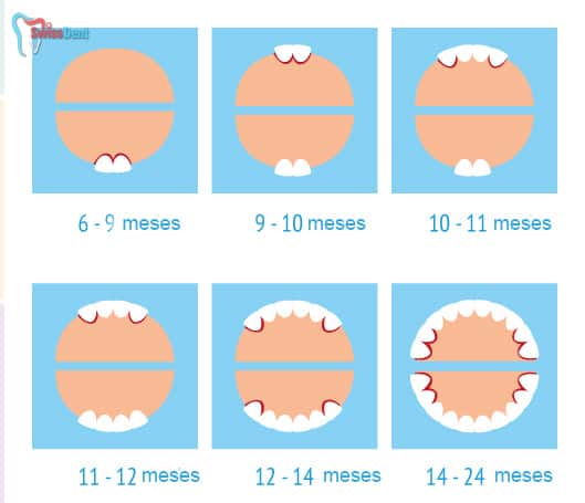 dientes de leche - dentista en ica