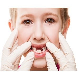 ¿Sabes que algunos hábitos causan dientes torcidos en los niños?