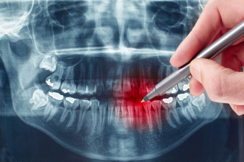 Swissdent Dentista Ica- Rx