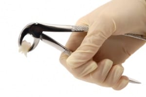 Dientes- Dentista Ica Swissdent